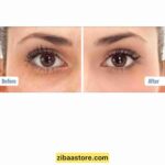 قبل و بعد استفاده از کرم دور چشم ویتامین c بالانس