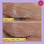 کرم دور چشم کلینیک مدل اسمارت