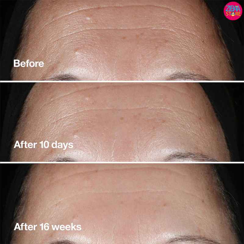 تاثیر سرم اسمارت کلینیکال ریپیر کلینیک روی پوست