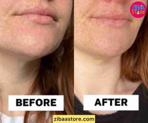 سرم سیکاپلاست لاروش پوزای