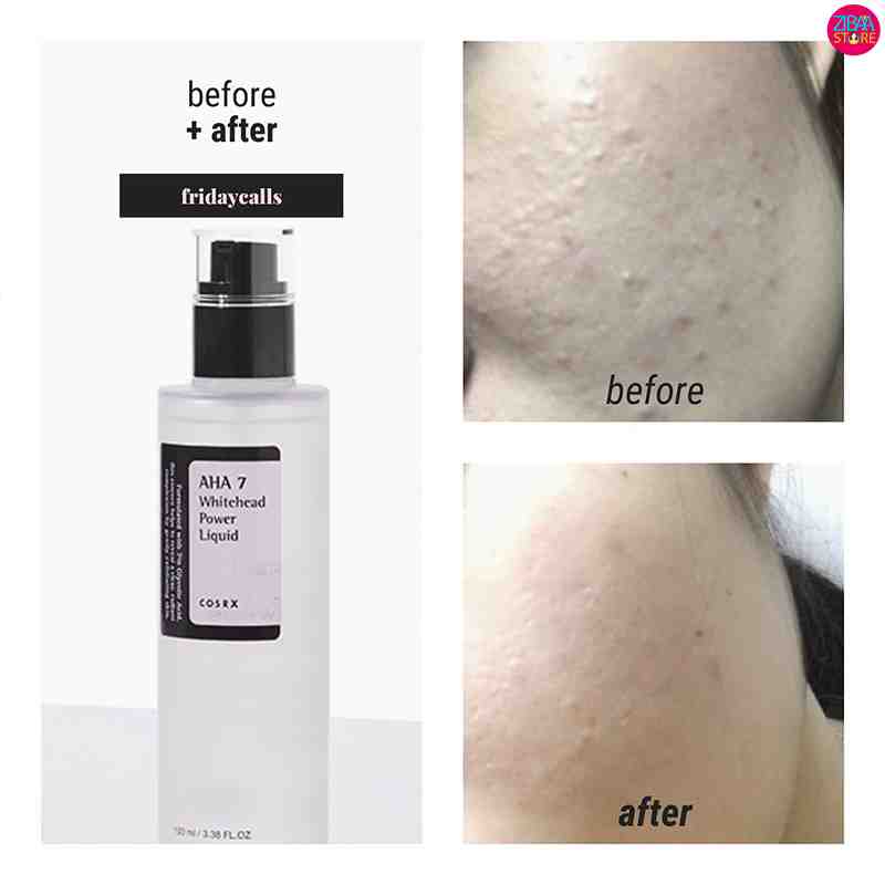 اسنس لایه بردار AHA کوزارکس