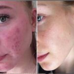 تونر لایه بردار پائولا چویس