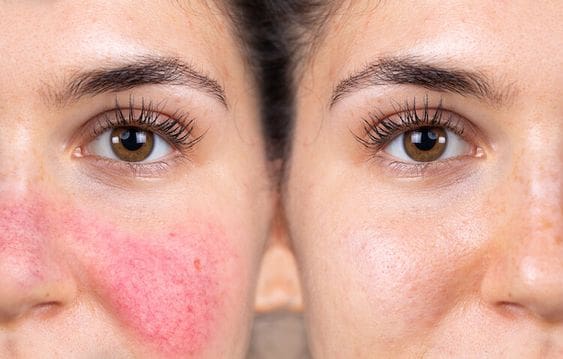 12 مشکل تابستانی رایج که می توانید جلوگیری کنید